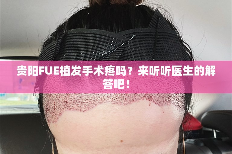 贵阳FUE植发手术疼吗？来听听医生的解答吧！