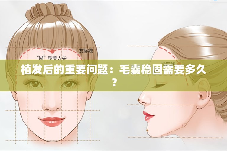 植发后的重要问题：毛囊稳固需要多久？