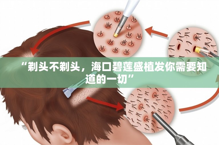 “剃头不剃头，海口碧莲盛植发你需要知道的一切”