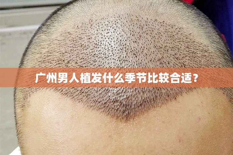 广州男人植发什么季节比较合适？