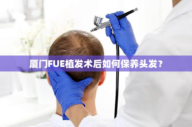 厦门FUE植发术后如何保养头发？