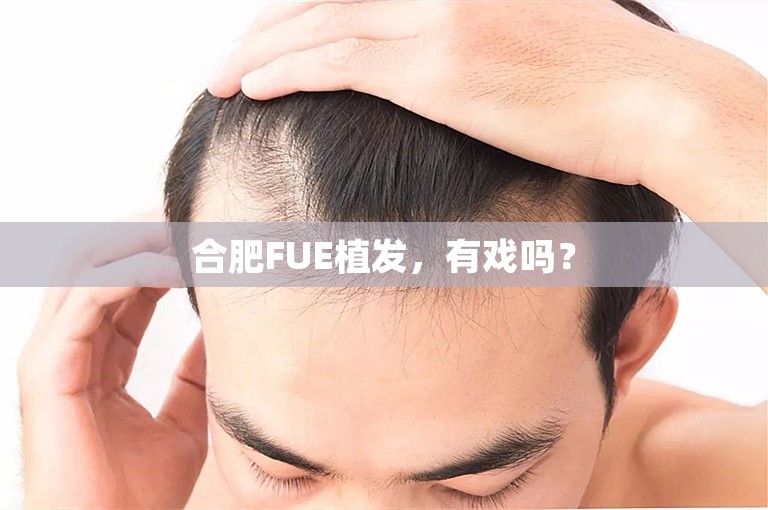 合肥FUE植发，有戏吗？