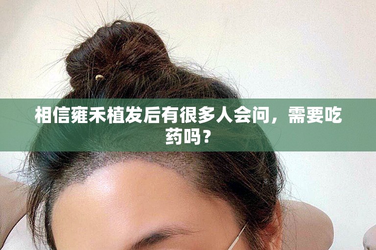 相信雍禾植发后有很多人会问，需要吃药吗？