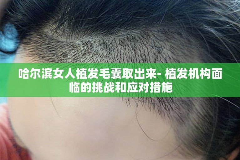 哈尔滨女人植发毛囊取出来- 植发机构面临的挑战和应对措施