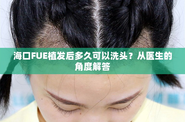 海口FUE植发后多久可以洗头？从医生的角度解答