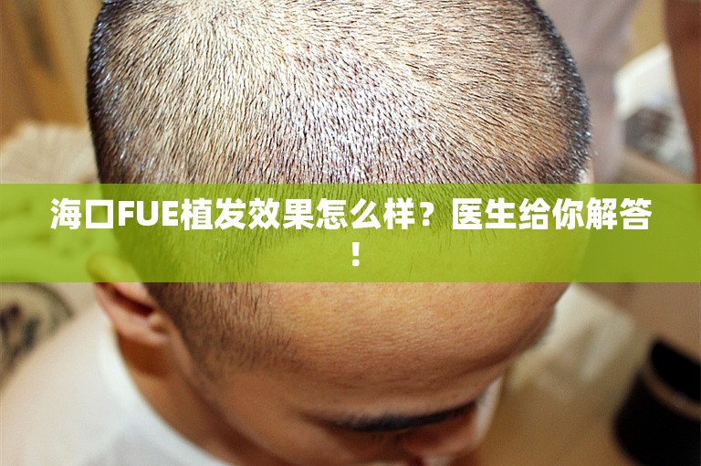 海口FUE植发效果怎么样？医生给你解答！