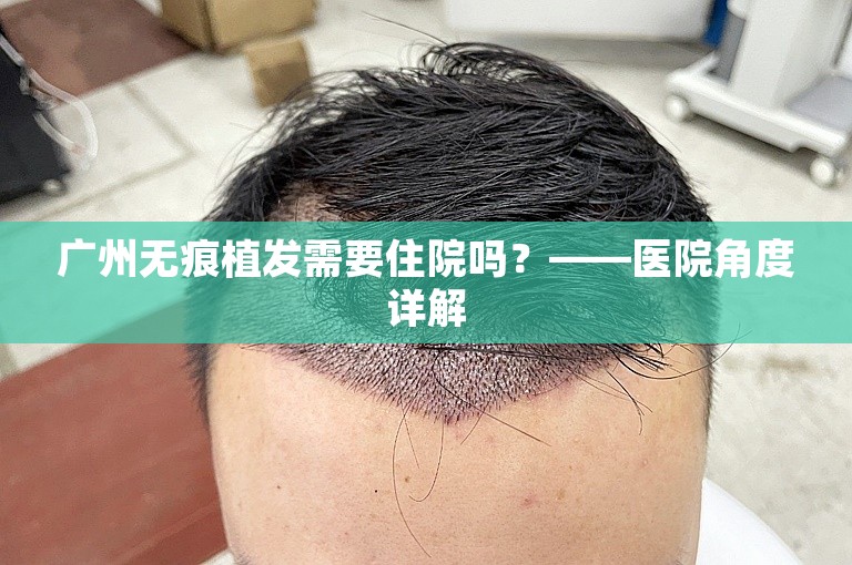 广州无痕植发需要住院吗？——医院角度详解