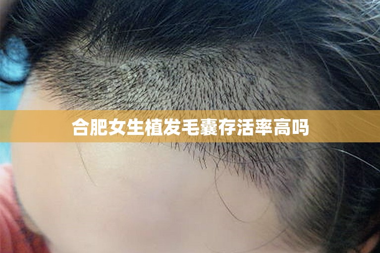 合肥女生植发毛囊存活率高吗