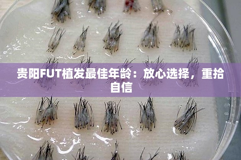 贵阳FUT植发最佳年龄：放心选择，重拾自信