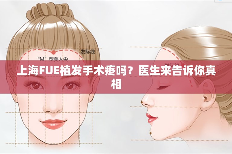 上海FUE植发手术疼吗？医生来告诉你真相