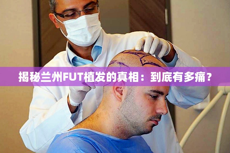 揭秘兰州FUT植发的真相：到底有多痛？