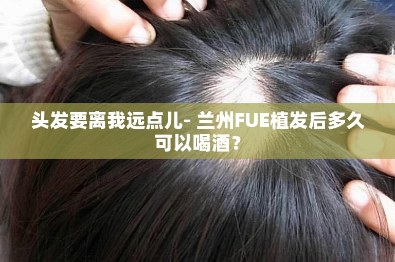 头发要离我远点儿- 兰州FUE植发后多久可以喝酒？