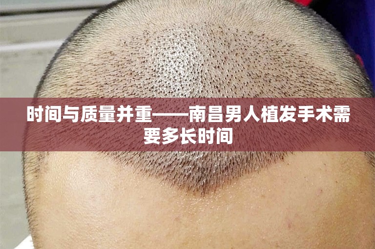 时间与质量并重——南昌男人植发手术需要多长时间