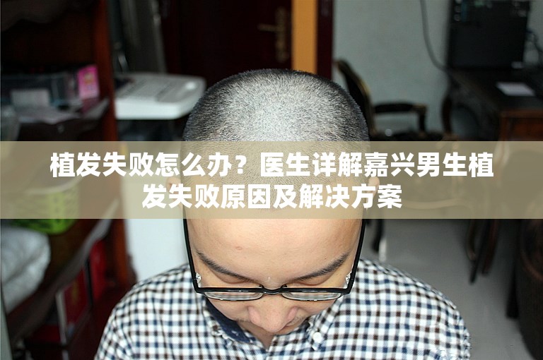 植发失败怎么办？医生详解嘉兴男生植发失败原因及解决方案