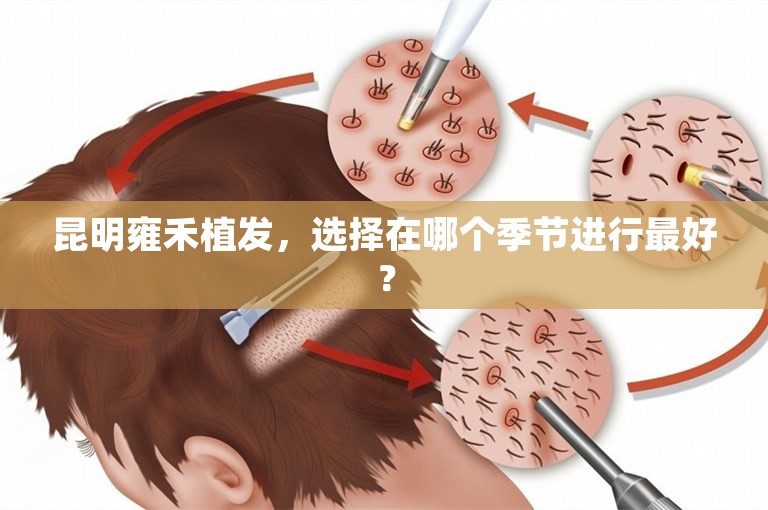 昆明雍禾植发，选择在哪个季节进行最好？