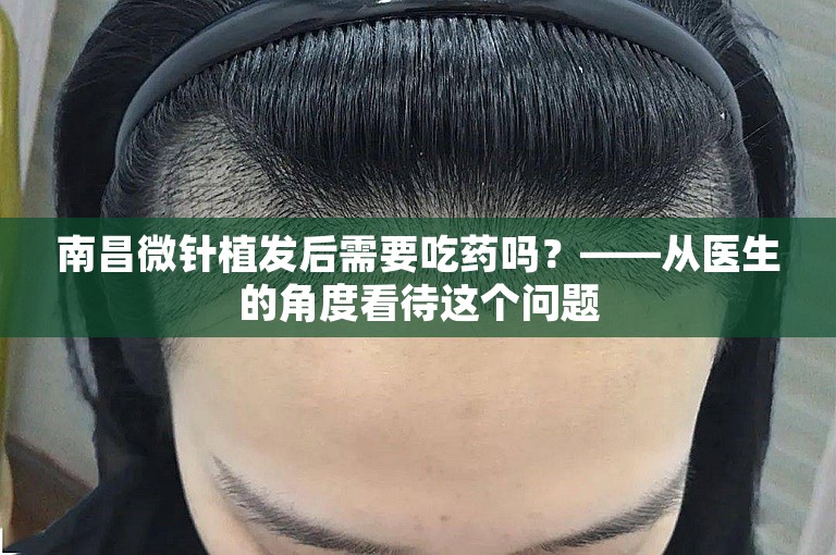 南昌微针植发后需要吃药吗？——从医生的角度看待这个问题