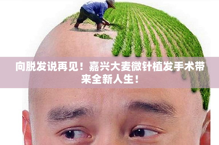 向脱发说再见！嘉兴大麦微针植发手术带来全新人生！