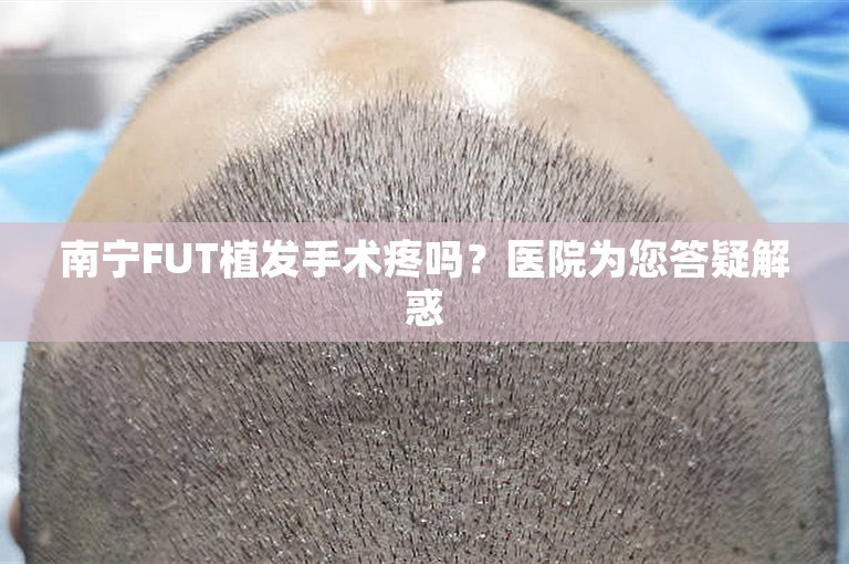 南宁FUT植发手术疼吗？医院为您答疑解惑