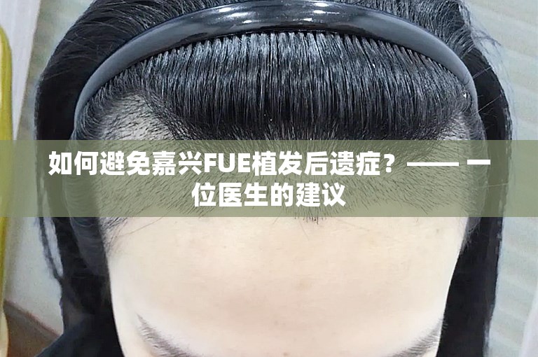 如何避免嘉兴FUE植发后遗症？—— 一位医生的建议