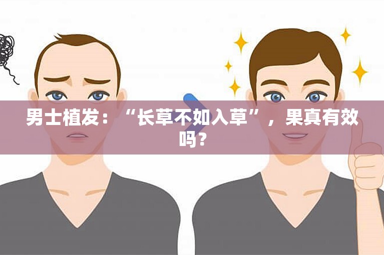 男士植发：“长草不如入草”，果真有效吗？