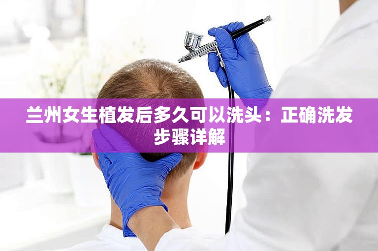 兰州女生植发后多久可以洗头：正确洗发步骤详解