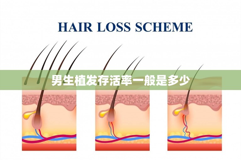 男生植发存活率一般是多少