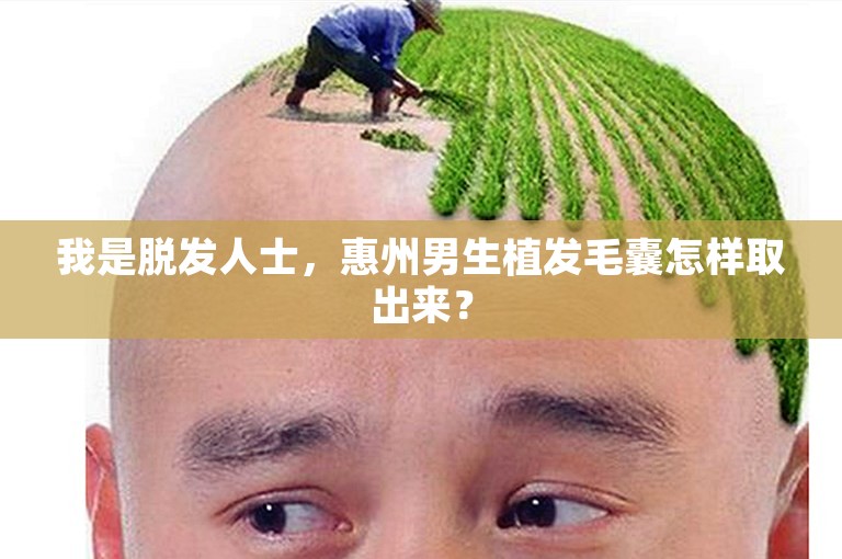 我是脱发人士，惠州男生植发毛囊怎样取出来？