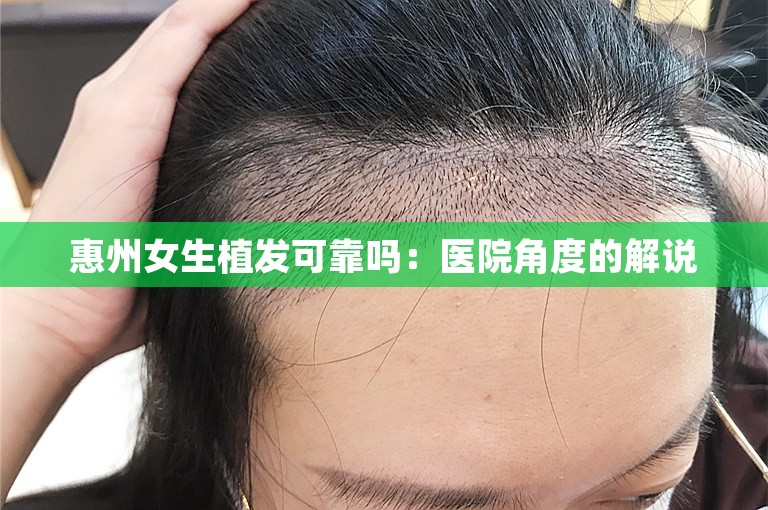 惠州女生植发可靠吗：医院角度的解说