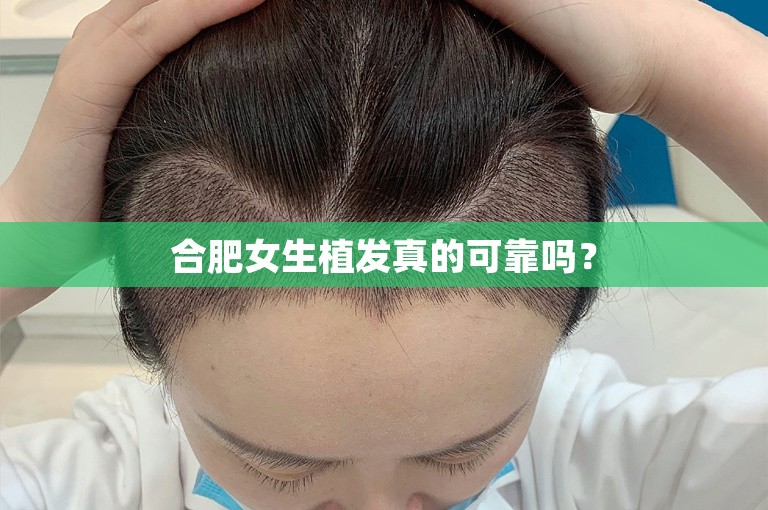 合肥女生植发真的可靠吗？