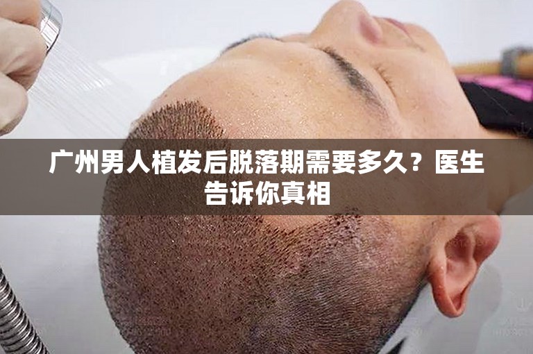 广州男人植发后脱落期需要多久？医生告诉你真相