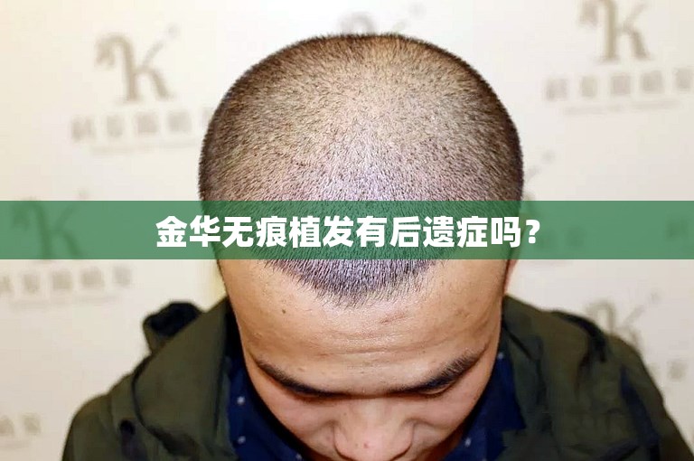 金华无痕植发有后遗症吗？