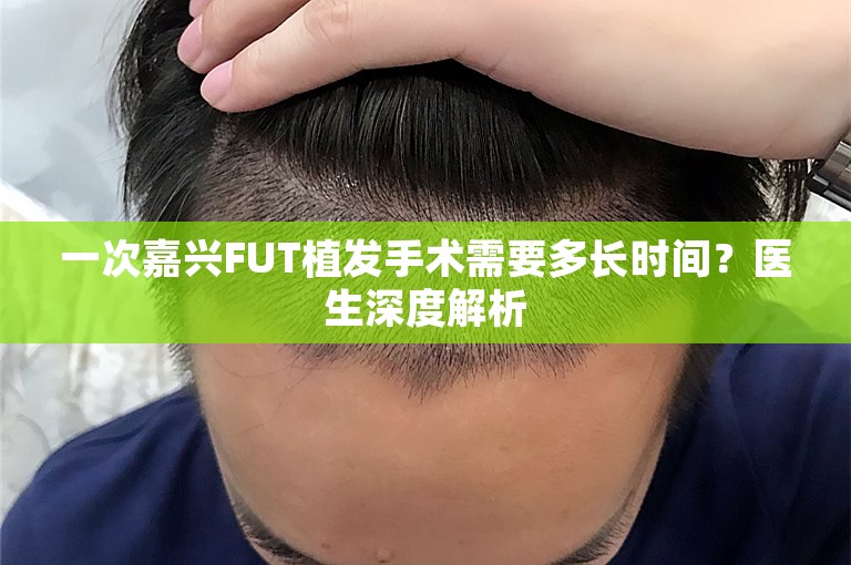 一次嘉兴FUT植发手术需要多长时间？医生深度解析