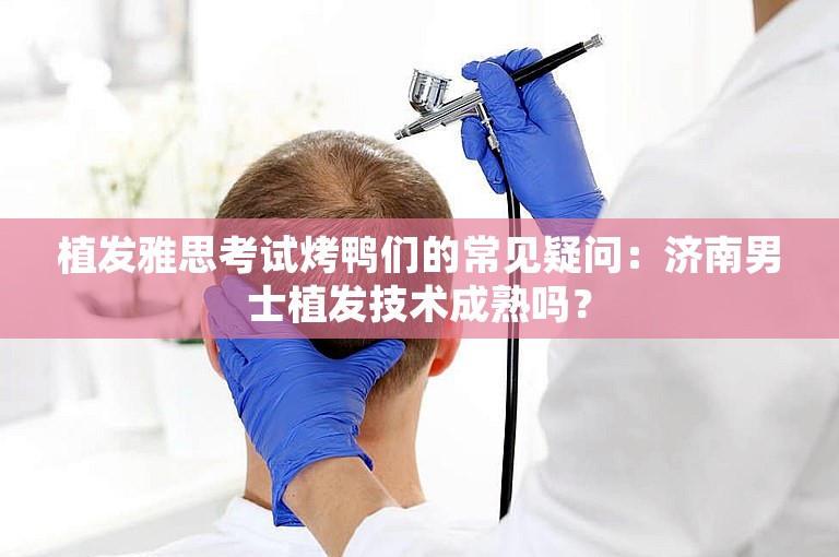 植发雅思考试烤鸭们的常见疑问：济南男士植发技术成熟吗？