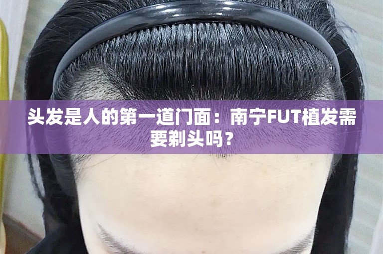 头发是人的第一道门面：南宁FUT植发需要剃头吗？