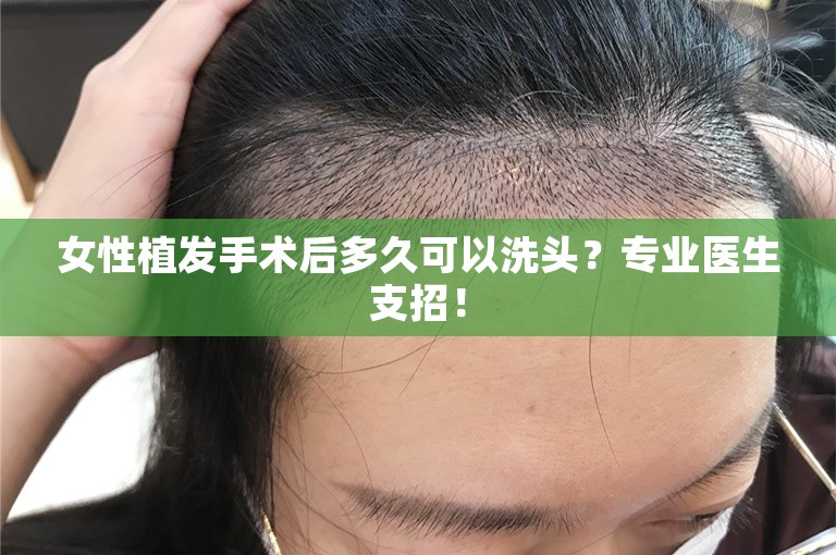 女性植发手术后多久可以洗头？专业医生支招！