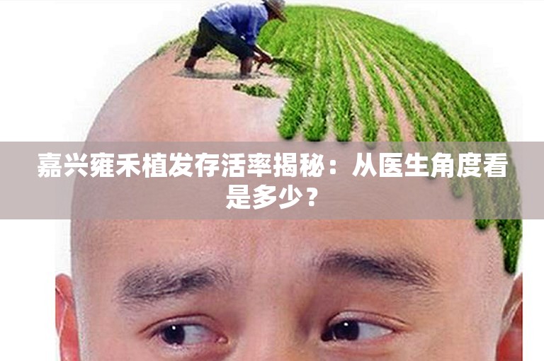 嘉兴雍禾植发存活率揭秘：从医生角度看是多少？