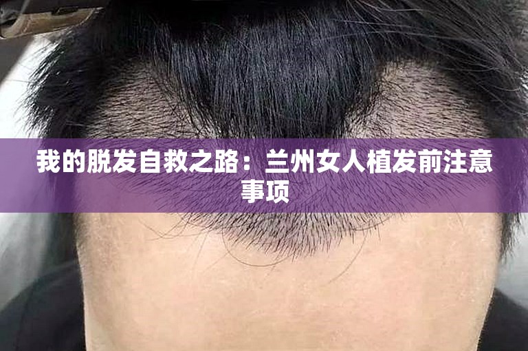 我的脱发自救之路：兰州女人植发前注意事项