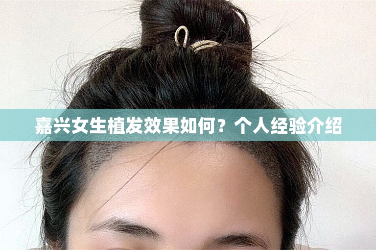 嘉兴女生植发效果如何？个人经验介绍