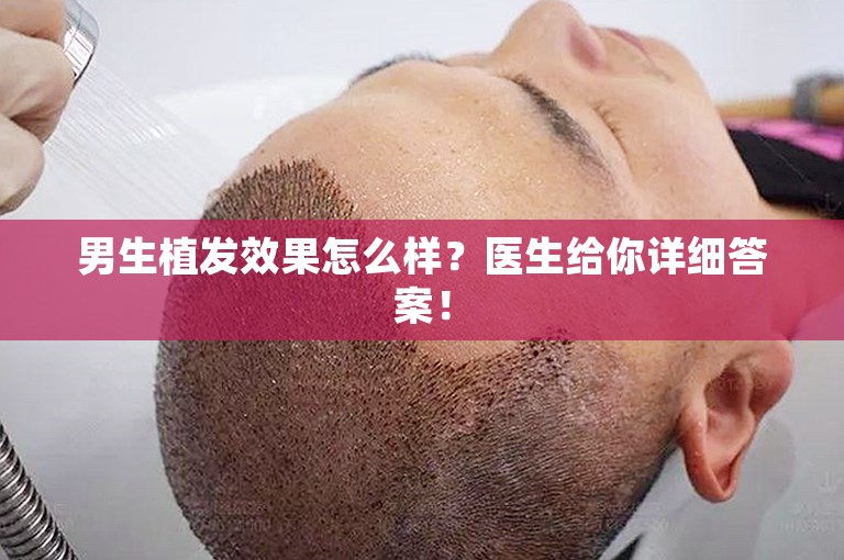 男生植发效果怎么样？医生给你详细答案！