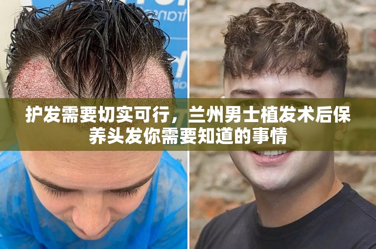 护发需要切实可行，兰州男士植发术后保养头发你需要知道的事情