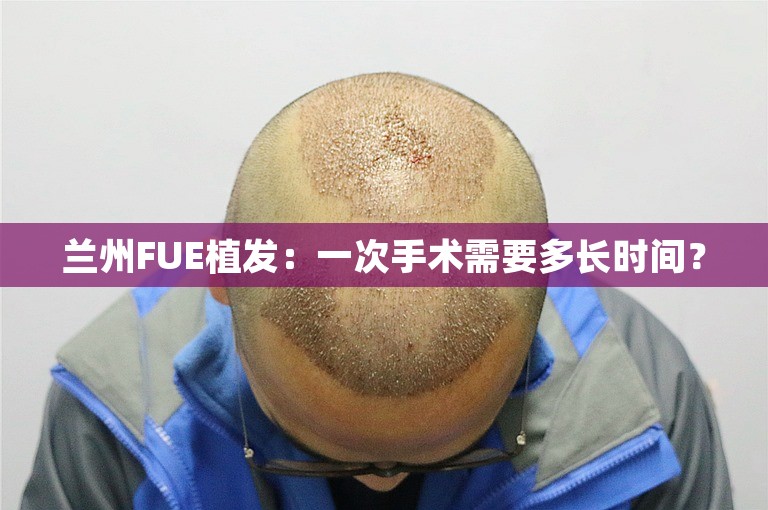 兰州FUE植发：一次手术需要多长时间？