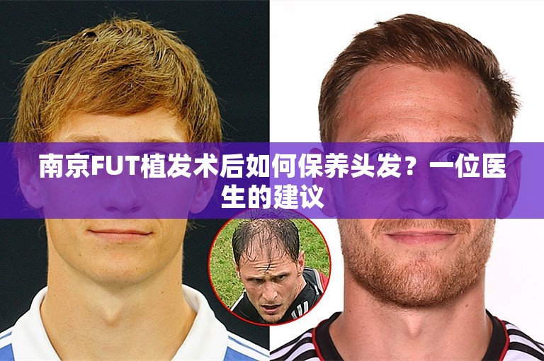 南京FUT植发术后如何保养头发？一位医生的建议