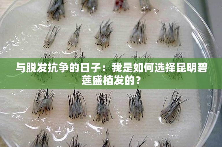 与脱发抗争的日子：我是如何选择昆明碧莲盛植发的？