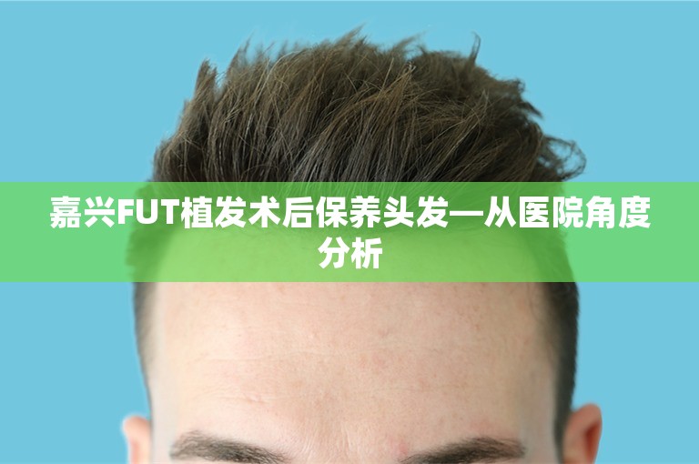 嘉兴FUT植发术后保养头发—从医院角度分析