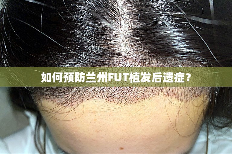 如何预防兰州FUT植发后遗症？