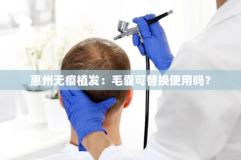 惠州无痕植发：毛囊可替换使用吗？