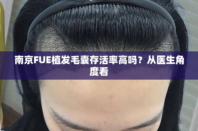 南京FUE植发毛囊存活率高吗？从医生角度看