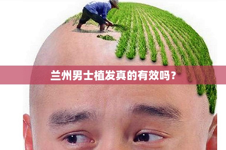 兰州男士植发真的有效吗？