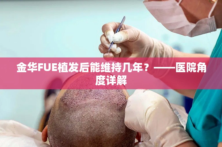 金华FUE植发后能维持几年？——医院角度详解