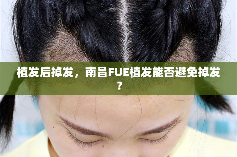 植发后掉发，南昌FUE植发能否避免掉发？